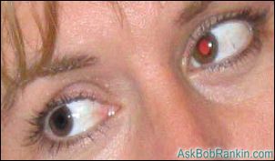 image editing - red eye