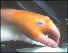 http://askbobrankin.com/rfid-implant.jpg